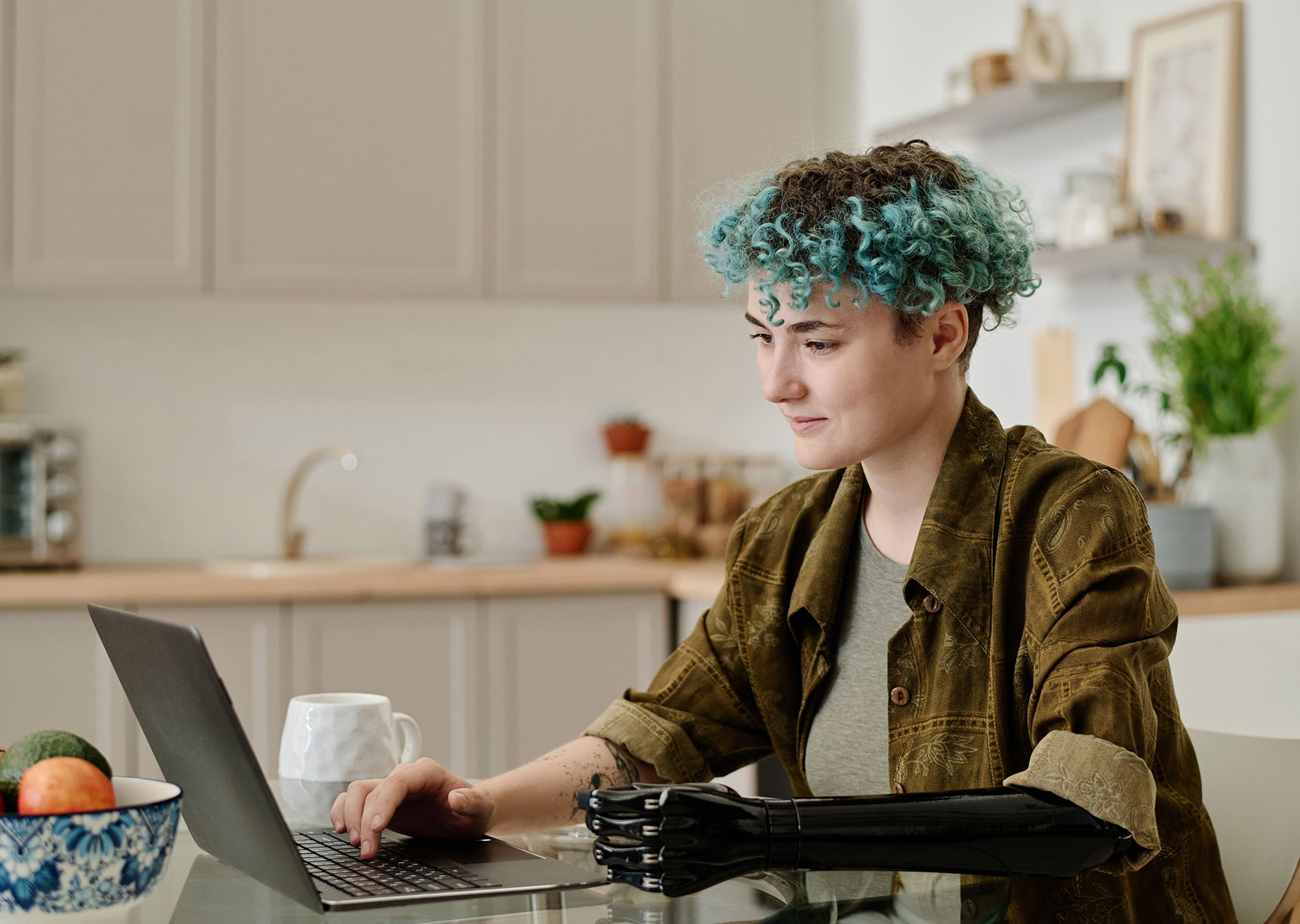 Young student with a prosthetic arm viewing a website on a laptop